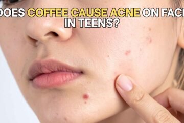 coffee-cause-acne-in-teens-explained-featured-img